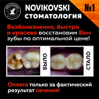 Лечение кариеса постоянного зуба у ребенка
